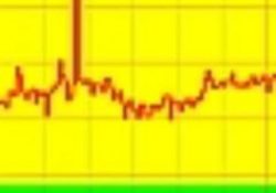 STOR2RRD 7.40 İle Gelen Yenilikler